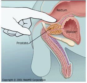 Anal test of prostrate