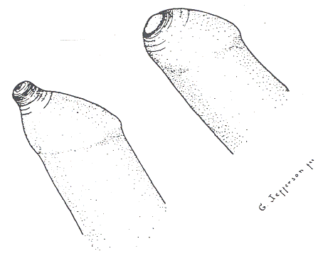 Foreskin Doesn T Retract When Erect