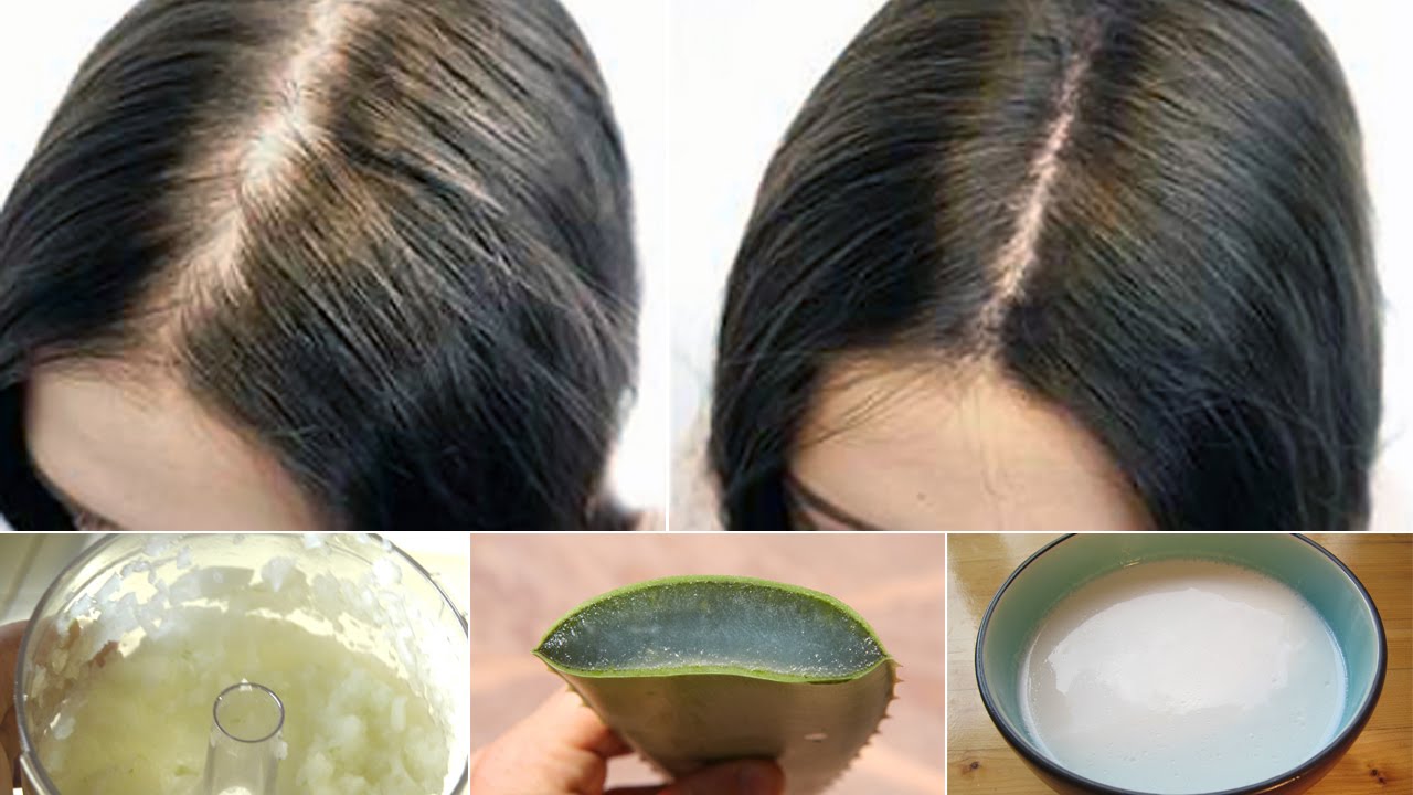 What To Do For Hair Loss Home Remedies