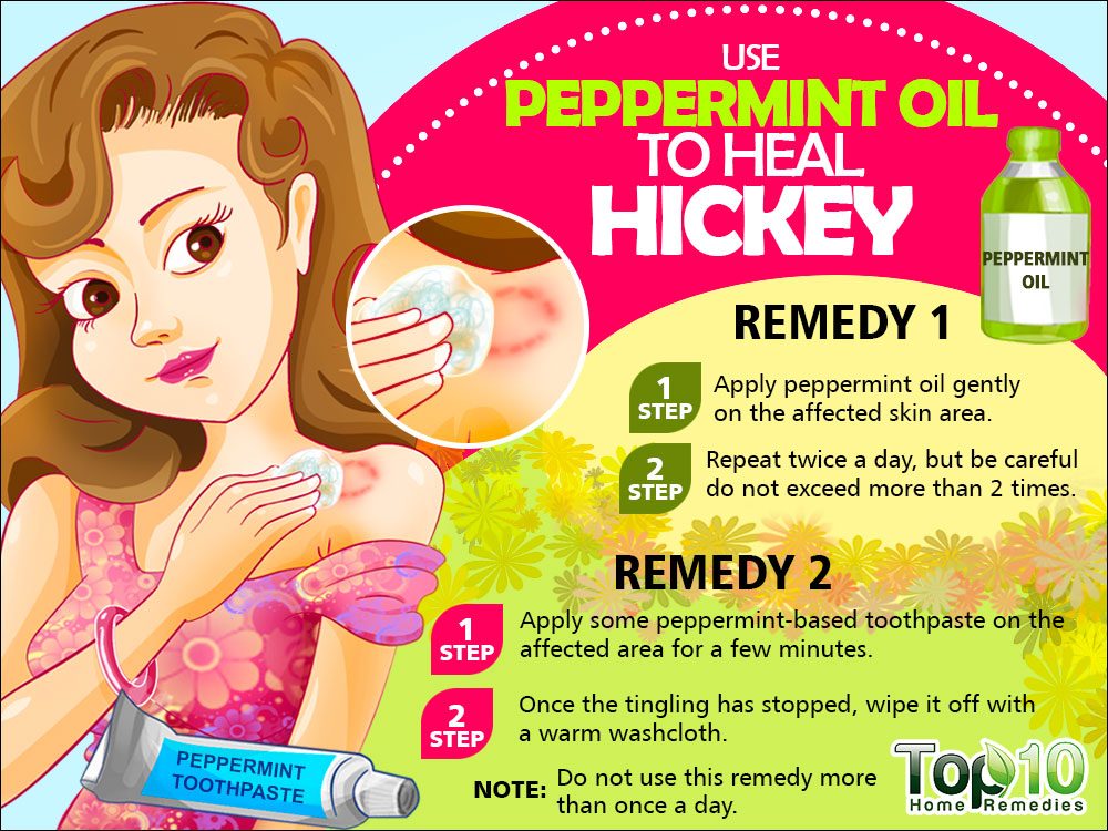Hot To Get Rid Of Hickeys